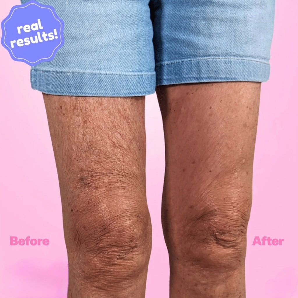 Lavix Lift Tape. Instant. Invisible. Yours.